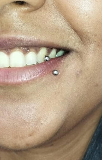 Labret lateral